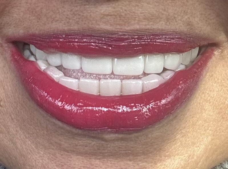 Smiles Family Dentistry 3