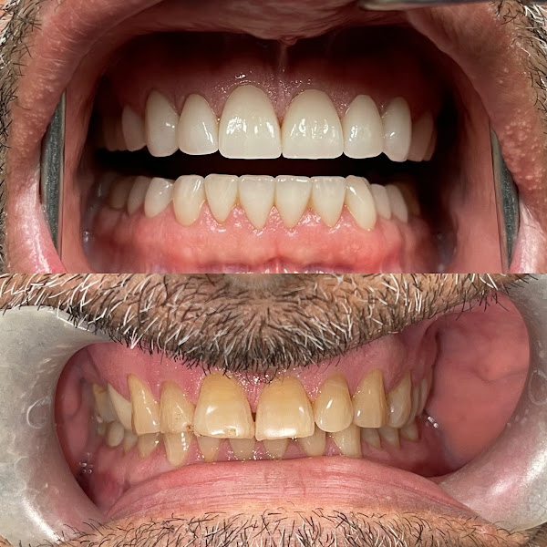 Celebration Family Dental of Carrollton 2