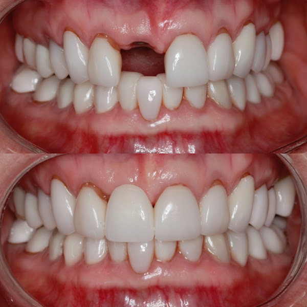 Dr. Lily Chen, Bellaire Cosmetic and Family Dental 3