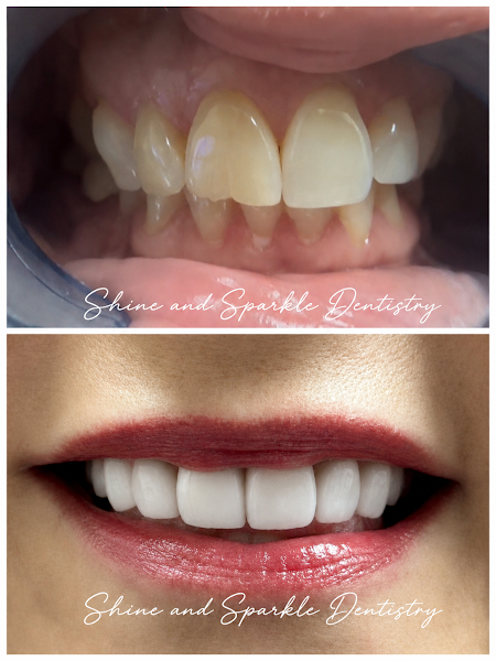 Shine and Sparkle Dentistry