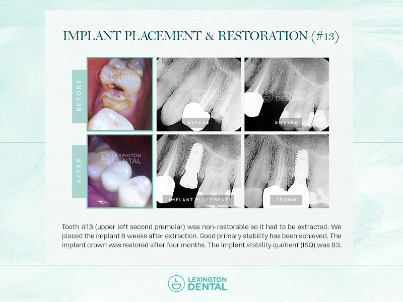 Lexington Dental Frisco 2