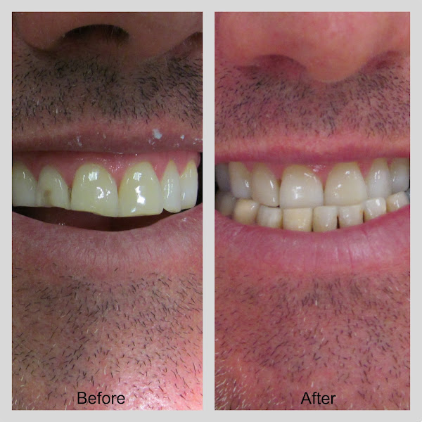 X DENTAL-Pearland 3