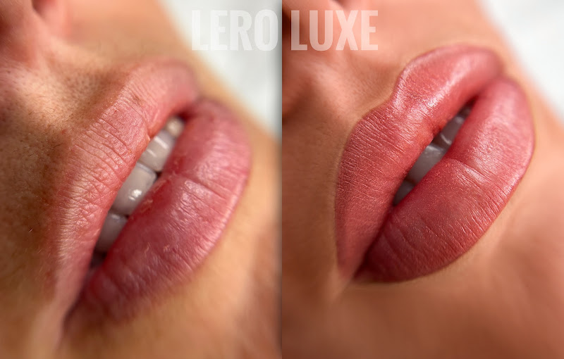 Lero Luxe PMU 3