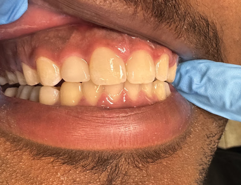 NOVA DENTAL LAS COLINAS 4