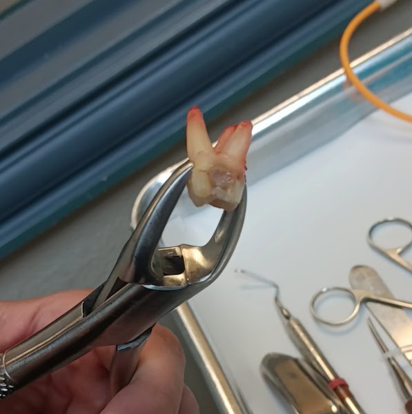 Dental Emergency Care 3