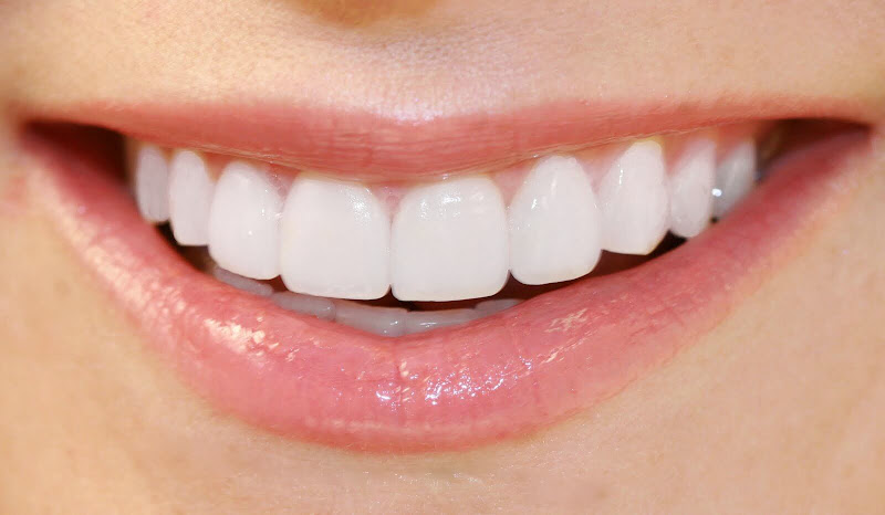 My DFW Dentist 2
