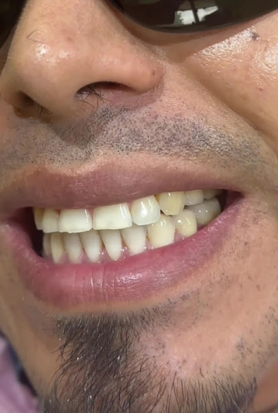 Dental Artistry Irving - Cosmetic and Family Dentistry 2