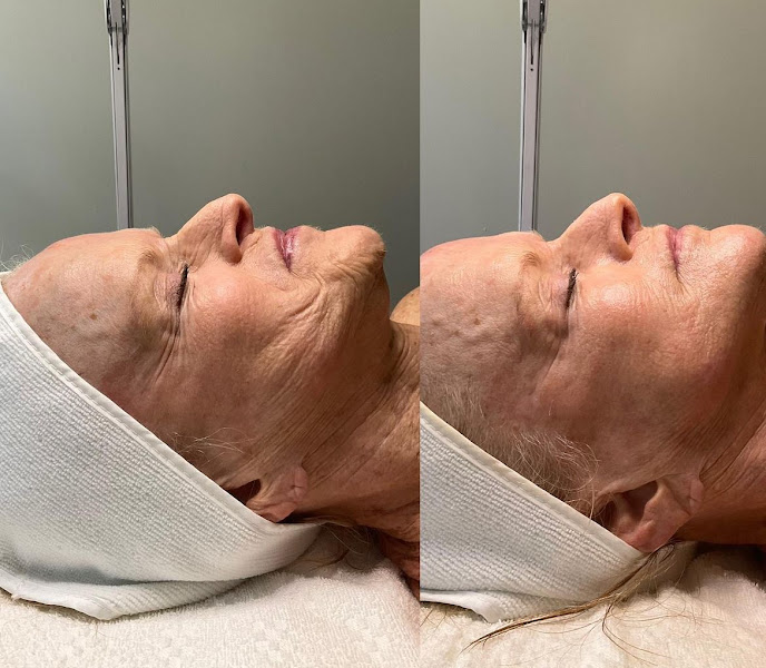 Ashley Sigdestad - Esthetician 2