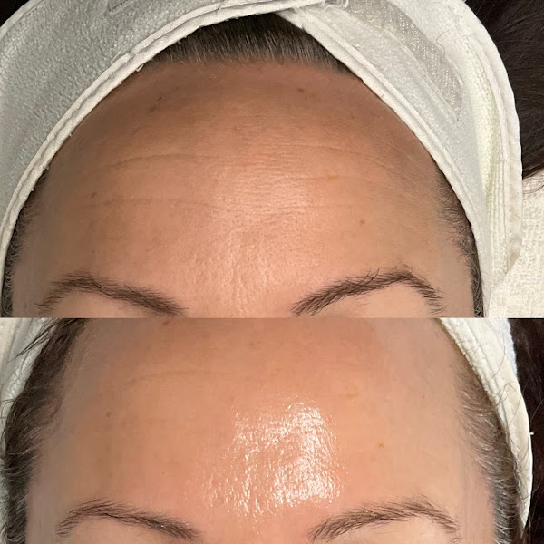 Ashley Sigdestad - Esthetician 3