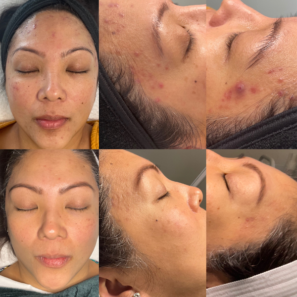 Ashley Sigdestad - Esthetician 4