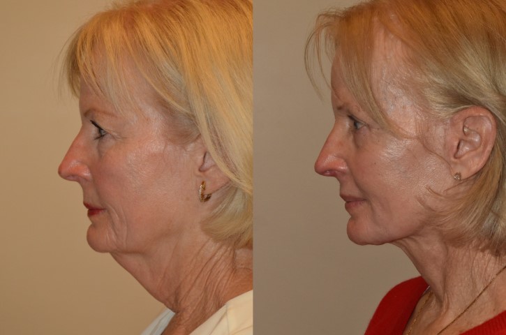 San Diego Skin - MedSpa & Laser 4