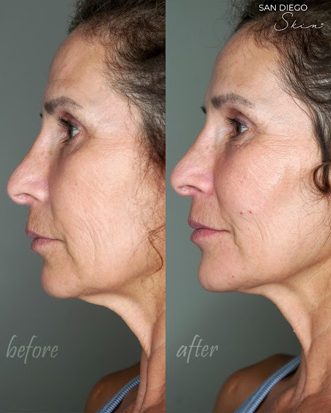 San Diego Skin - MedSpa & Laser 5
