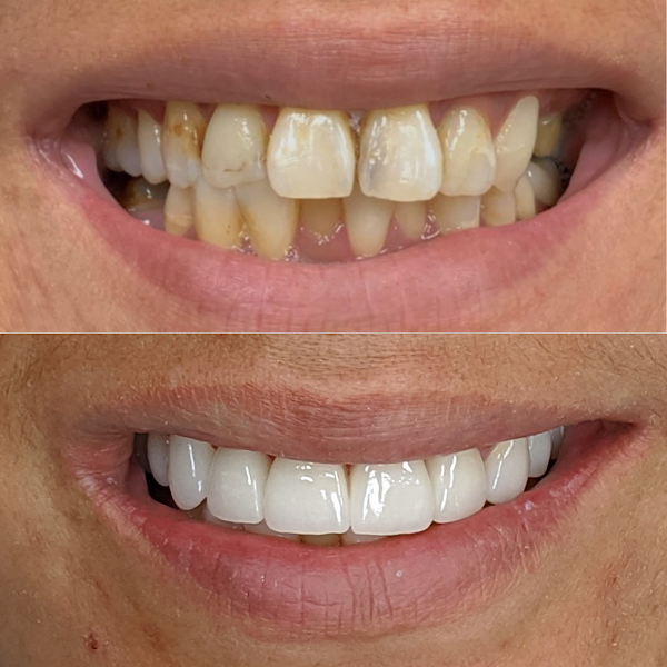 Spring Dentist 3
