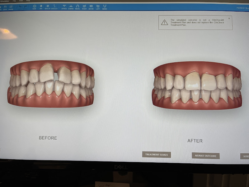 Spring Dentist 4