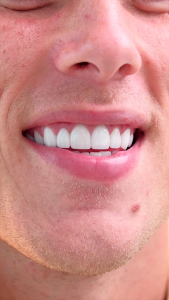 Glo Dental Group & Orthodontics Cypress 2