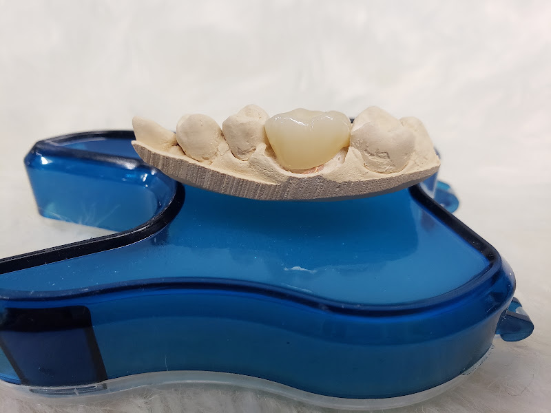 Lone Star Family Dental - Pasadena Tx 5