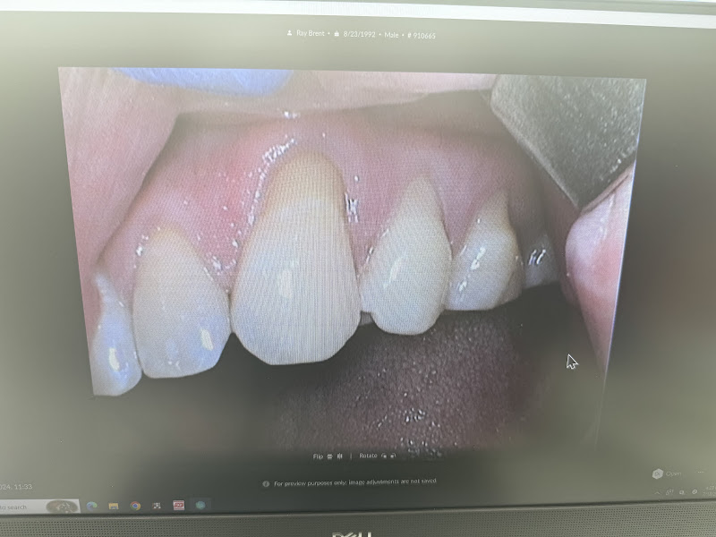 Capitol Hill Seattle Dentist 5