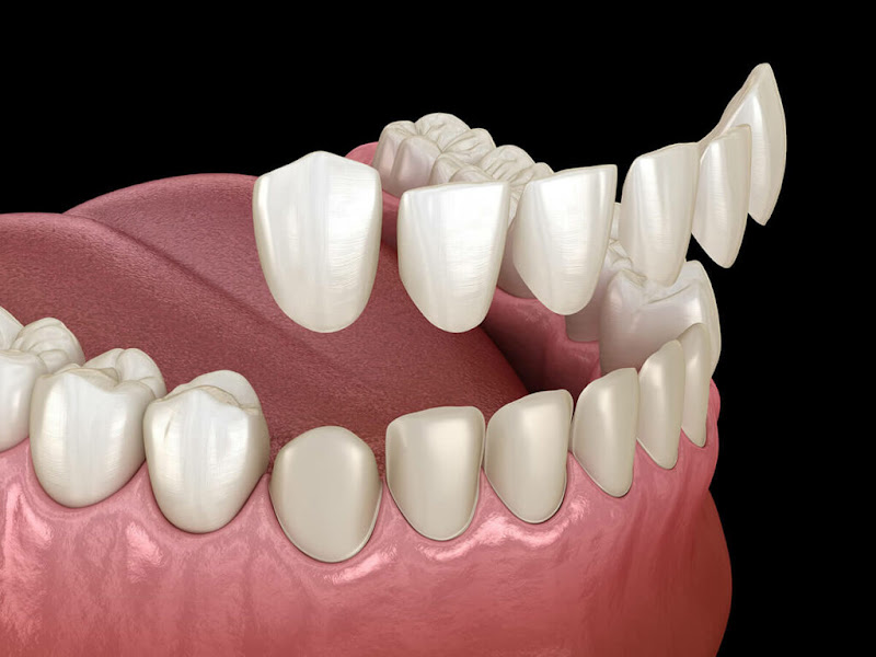 Tacoma Dental Care, Dr. Thi Truong Nguyen, DMD. 3