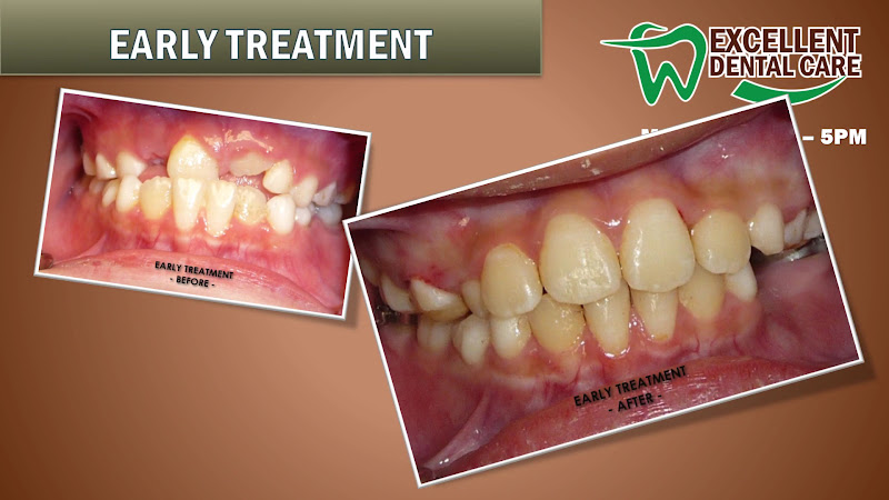 Excellent Dental Care Center 3