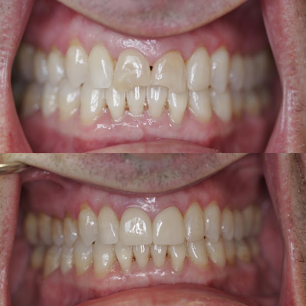 Advanced Dental Care - Tacoma 4