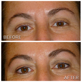 Permanent Makeup by Ann 4