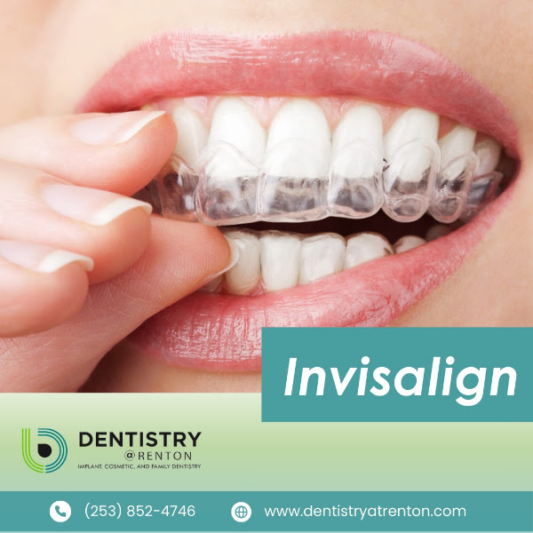 Dentistry at Renton 4