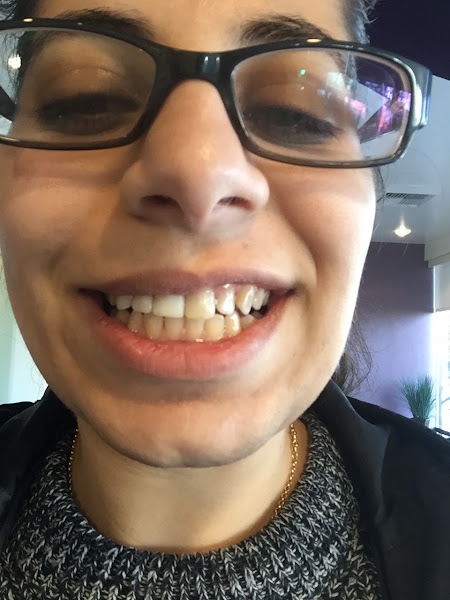 Bright Now! Dental & Orthodontics - Kent, WA 5