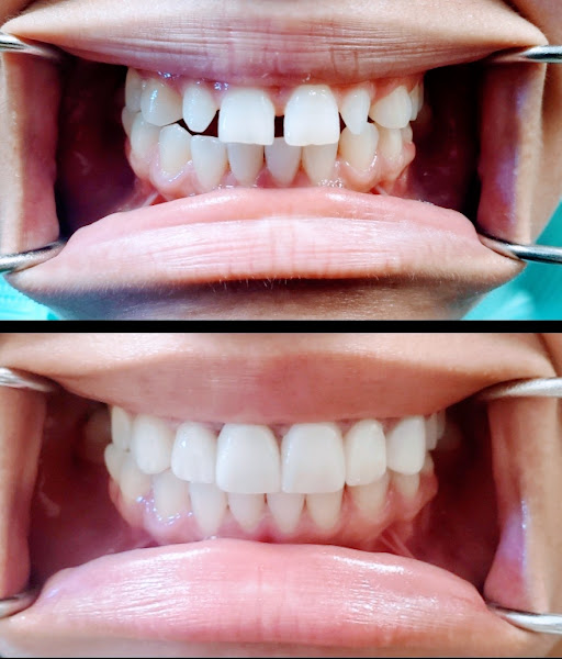Complete Dental Care 5