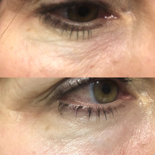Beauty up Medical Skin Care and Weight Loss 2