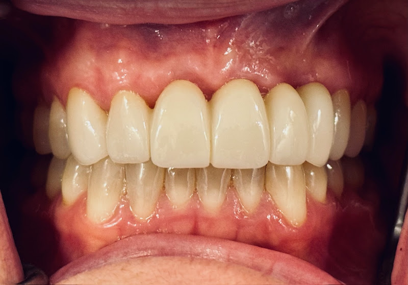 Nova Premier Dental 4