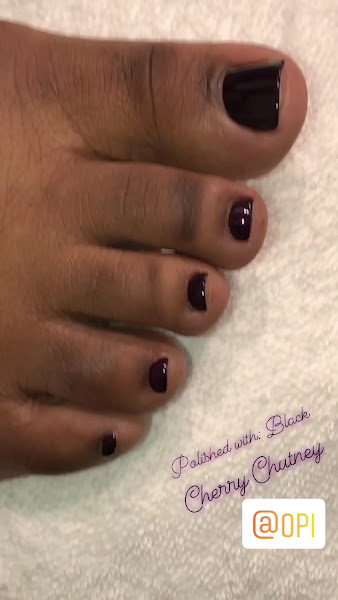 NEATEN Foot & Nail Care – Orlando Advanced Pedicures & Toenail Correction 3