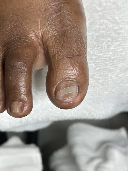 NEATEN Foot & Nail Care – Orlando Advanced Pedicures & Toenail Correction 4