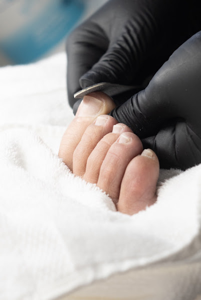 NEATEN Foot & Nail Care – Orlando Advanced Pedicures & Toenail Correction 5