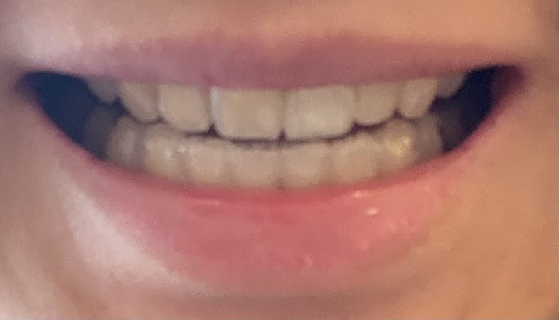 Xusheng Mu, DDS 2
