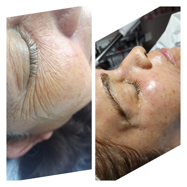 Atlanta Skin Care 4