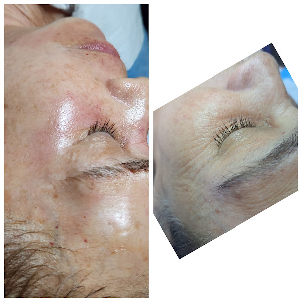 Atlanta Skin Care 5