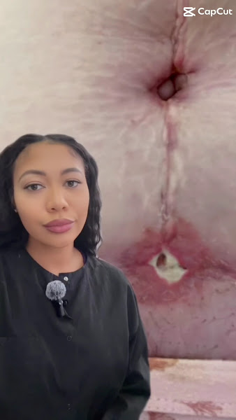 La Beauty Lab Post-Op Spa & Recovery Clinic 3