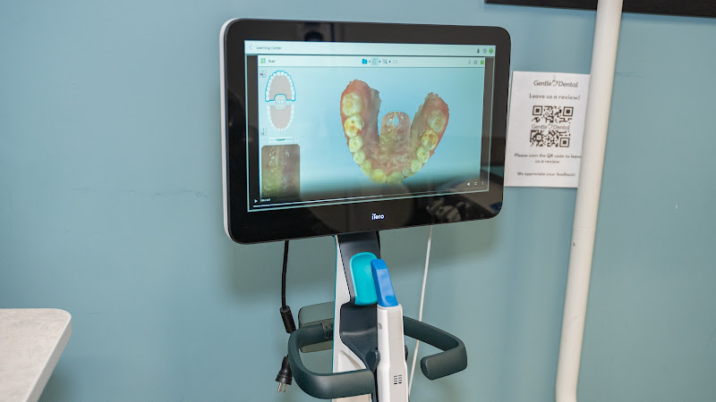 Gentle Dental Chula Vista 4