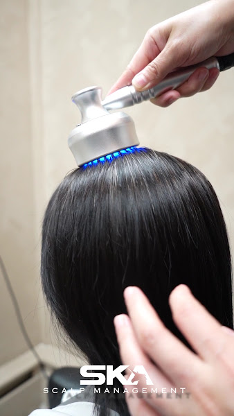 SKA Scalp | Skin Aesthetics 3