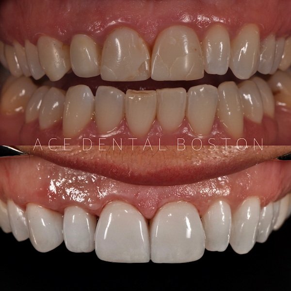 Ace Dental Boston 4