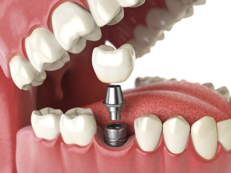 Mass Dental Associates 2