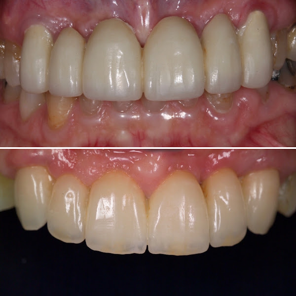 Charlotte Dentist - Steven H. Ghim, DMD 1