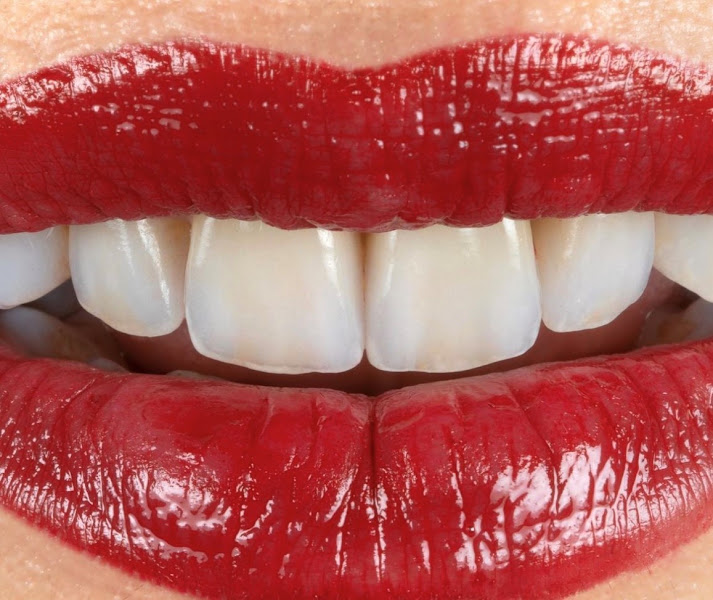 Charlotte Dentist - Steven H. Ghim, DMD 5