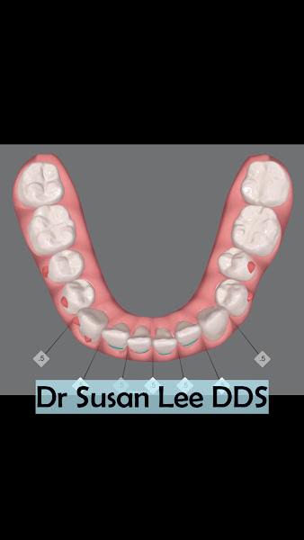 Susan H. Lee D.D.S. Healthy Teeth Dental 3