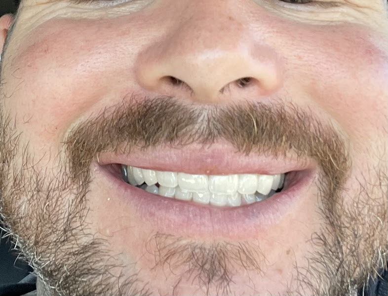 Dentists of Anaheim Hills 5