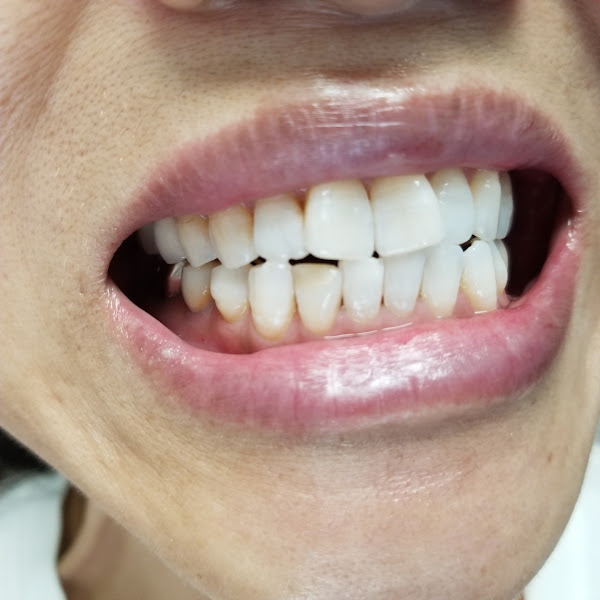 California Dental Group of North Anaheim 2