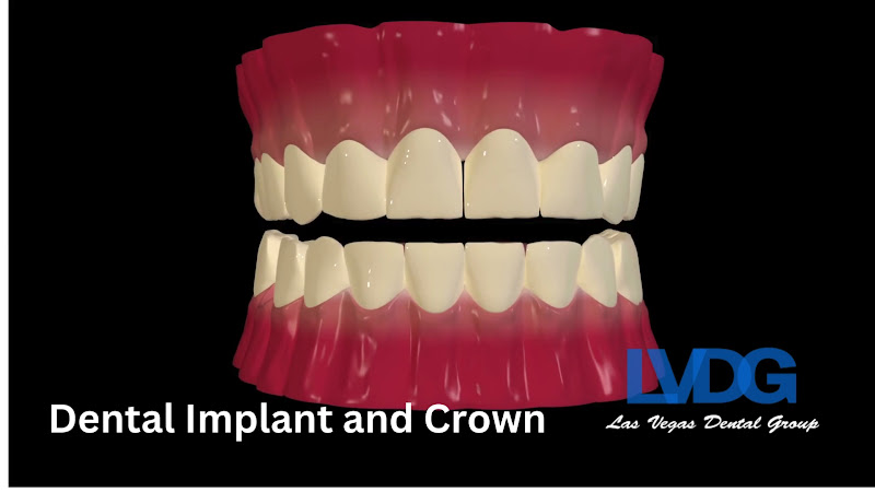 Las Vegas Dental Group 5