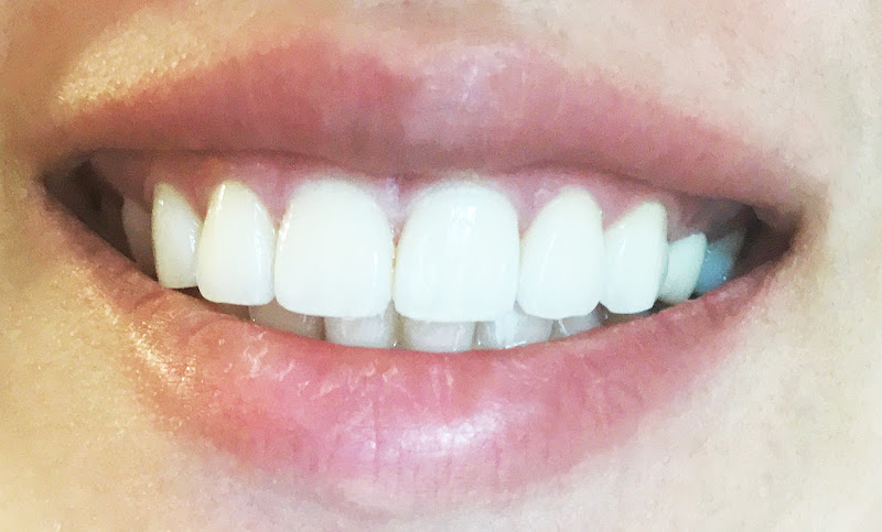 Hollywood Smile Dental 4