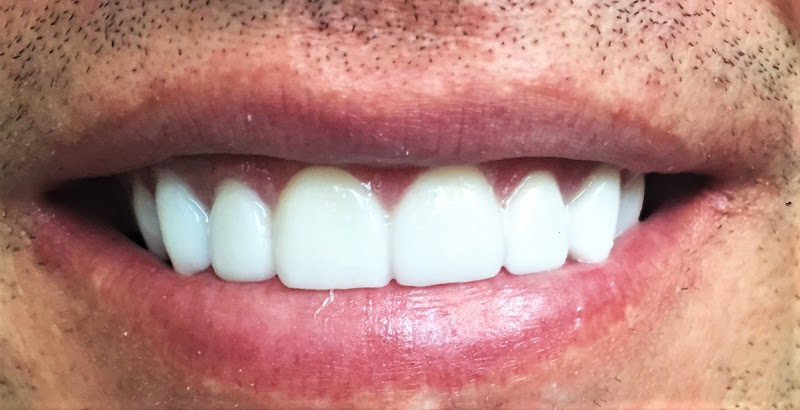 Hollywood Smile Dental 5