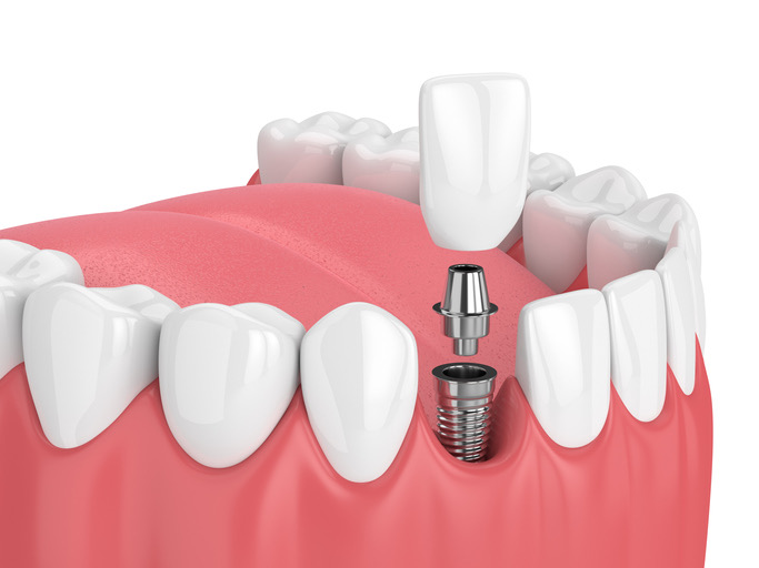 Nevada Dentistry & Braces 2